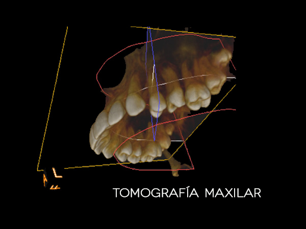 SADENTIS imagenología tomografías y radiografías